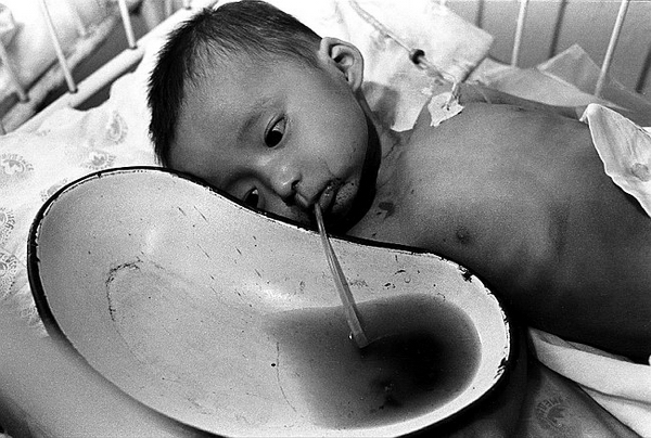Из-за антисанитарии и отсутствии питьевой воды дети обречены на заболевание брюшным тифом